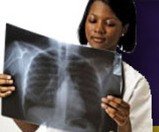 bronchitis2